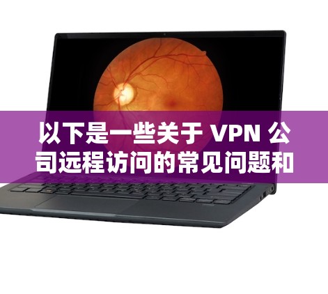 以下是一些关于 VPN 公司远程访问的常见问题和建议